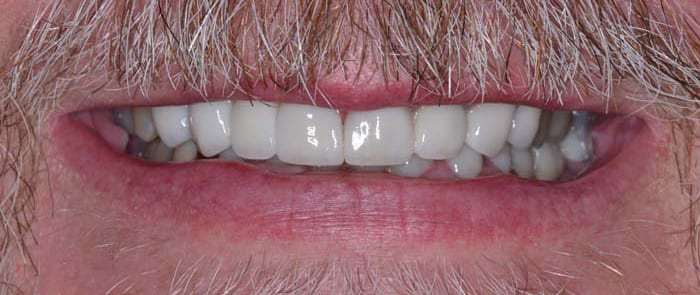 Before and After Dentistry Photos